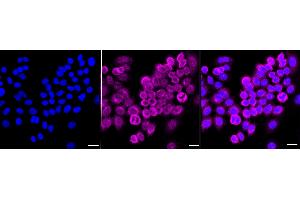 Immunocytochemical staining of HepG2 cells with NF-kB p65 antibody (ABIN7799645), 1:1,000). (Recombinant NF-kB p65 anticorps)