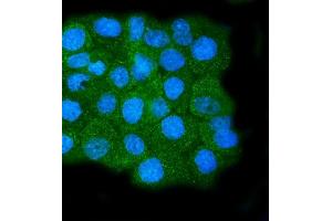 IF analysis of Calpain 1 using anti-Calpain 1 antibody (ABIN7601600).