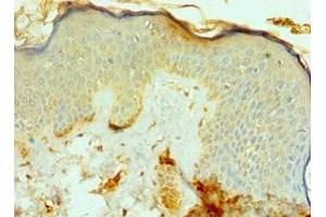 Immunohistochemistry of paraffin-embedded human skin tissue using ABIN7164791 at dilution of 1:100 (FAP anticorps  (AA 26-280))