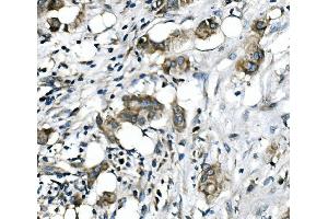 IHC analysis of RICTOR using anti-RICTOR antibody (ABIN7600744). (RICTOR anticorps  (AA 23-264))