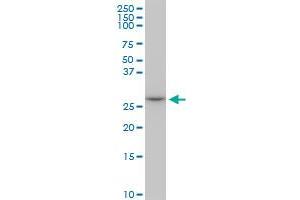 MAGEA12 monoclonal antibody (M01), clone 3A10.