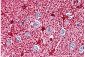 anti-Glutamate-Ammonia Ligase (GLUL) antibody