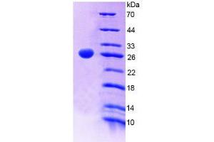 SDS-PAGE (SDS) image for Protein Tyrosine Phosphatase Receptor Type F (PTPRF) (AA 30-224) protein (His tag) (ABIN6239064)