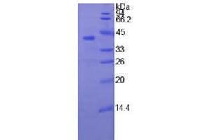SDS-PAGE analysis of Human TNNT1 Protein. (TNNT1 Protéine)