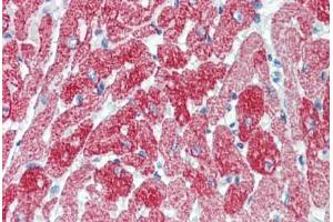 Human Rabbit Heart (formalin-fixed, paraffin-embedded) stained with TNNT2 antibody ABIN462337 followed by biotinylated anti-mouse IgG secondary antibody ABIN481714, alkaline phosphatase-streptavidin and chromogen. (Cardiac Troponin T2 anticorps  (Exon 10))