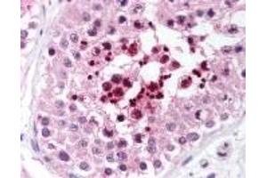 Immunohistochemistry (IHC) image for anti-RAP1 Interacting Factor Homolog (RIF1) (AA 2406-2419) antibody (ABIN2469662)