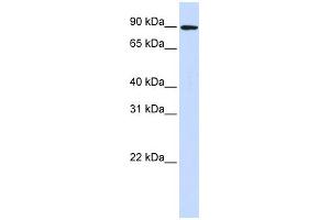 WB Suggested Anti-DLG3 Antibody Titration:  0.