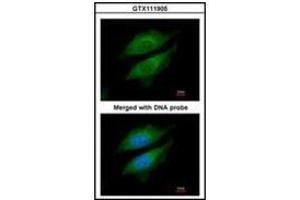 Immunofluorescence analysis of paraformaldehyde-fixed HeLa, using DPRP1 antibody at 1/200 dilution. (DPP8 anticorps)