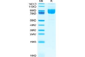 Mouse Siglec-4a/MAG on Tris-Bis PAGE under reduced condition. (MAG Protein (AA 20-516) (His tag))