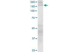 COL1A1 monoclonal antibody (M01), clone 3G3.