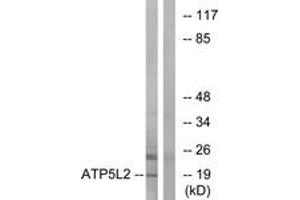 Western blot analysis of extracts from A549 cells, using ATP5L2 Antibody.