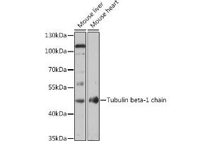 Western blot analysis of extracts of various cell lines, using Tubulin beta-1 chain antibody (ABIN7271046) at 1:1000 dilution.