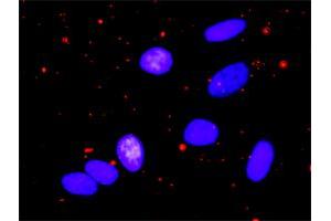 Proximity Ligation Analysis of protein-protein interactions between IKBKB and RELA.