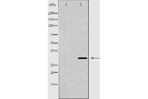 Western blot analysis of extracts of Mouse brain tissue lysate, using GJB3 antibody. (Connexin 31 anticorps  (C-Term))