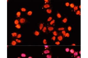 Immunofluorescence analysis of HeLa cells using XRCC1 Polyclonal Antibody at dilution of 1:100 (40x lens). (XRCC1 anticorps)