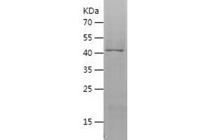 Western Blotting (WB) image for Vanin 2 (VNN2) (AA 279-492) protein (His-IF2DI Tag) (ABIN7125697)