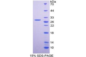 Image no. 1 for Platelet Derived Growth Factor Receptor alpha (PDGFRA) (AA 170-387) protein (His tag) (ABIN6236823)