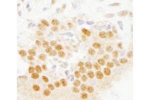 anti-SET Domain Containing 8 Pseudogene 1 (SETD8P1) (AA 316-366) antibody