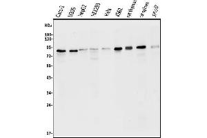 Western blot analysis of ATG7 using anti-ATG7 antibody (ABIN7603109).