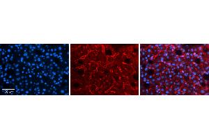 Rabbit Anti-LBP Antibody   Formalin Fixed Paraffin Embedded Tissue: Human Liver Tissue Observed Staining: Cytoplasm and plasma membrane in endothelial cells in sinusoids Primary Antibody Concentration: 1:100 Other Working Concentrations: 1:600 Secondary Antibody: Donkey anti-Rabbit-Cy3 Secondary Antibody Concentration: 1:200 Magnification: 20X Exposure Time: 0.