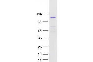 Validation with Western Blot