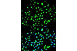 Immunofluorescence analysis of HeLa cell using YWHAQ antibody. (14-3-3 theta anticorps  (AA 1-245))