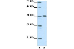 WB Suggested Anti-ZNF259 Antibody Titration:  0.