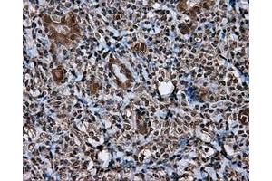 Immunohistochemical staining of paraffin-embedded Kidney tissue using anti-MCL1 mouse monoclonal antibody. (MCL-1 anticorps)
