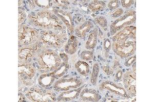 ABIN6266622 at 1/100 staining human kidney tissue sections by IHC-P. (PDGFRA anticorps  (Internal Region))