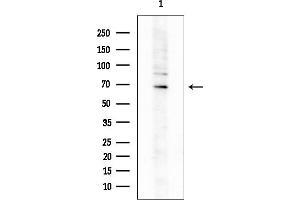 anti-Zinc Finger Protein 668 (ZNF668) (Internal Region) antibody