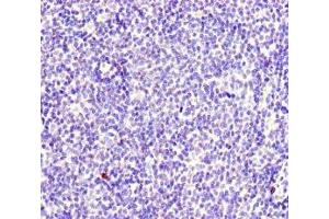 Immunohistochemistry of paraffin-embedded human lymph node tissue using ABIN7174949 at dilution of 1:100