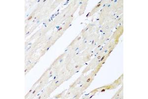 Immunohistochemistry of paraffin-embedded rat heart using VCP antibody.