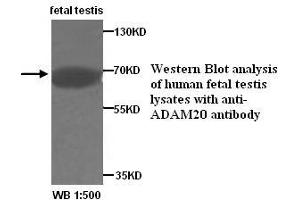 Image no. 1 for anti-ADAM Metallopeptidase Domain 20 (ADAM20) antibody (ABIN1574462)