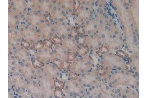 anti-serum/glucocorticoid Regulated Kinase 1 (SGK1) (AA 145-386) antibody