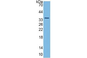 Rabbit Capture antibody from the kit in WB with Positive Control: Sample Human Brain Tissue.