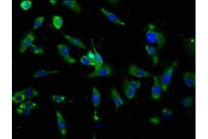 Immunofluorescence staining of U251 cells with ABIN7144516 at 1:166, counter-stained with DAPI.