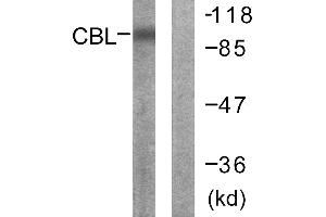 Immunohistochemistry analysis of paraffin-embedded human breast carcinoma tissue using CBL (Ab-700) antibody. (CBL anticorps  (Tyr700))