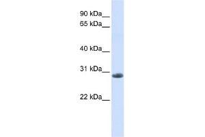 YIPF6 antibody used at 1 ug/ml to detect target protein. (YIPF6 anticorps  (C-Term))