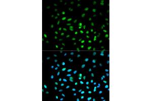 Immunofluorescence analysis of MCF-7 cells using STK11 antibody. (LKB1 anticorps)