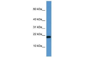 WB Suggested Anti-SH2D1A Antibody Titration: 0. (SH2D1A anticorps  (C-Term))