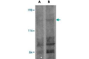 Western blot analysis of FRMPD1 in K-562 cell lysate with FRMPD1 polyclonal antibody  at (A) 1 and (B) 2 ug/mL . (FRMPD1 anticorps  (C-Term))