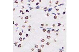 Immunohistochemical analysis of FIR staining in human kidney formalin fixed paraffin embedded tissue section. (FARP2 anticorps)