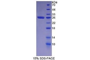 SDS-PAGE (SDS) image for Glutathione S-Transferase alpha 2 (GSTa2) (AA 1-222) protein (His tag) (ABIN1079682) (GSTa2 Protein (AA 1-222) (His tag))