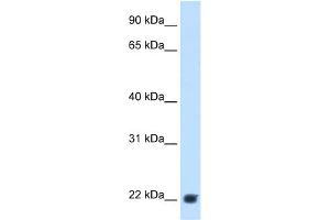 WB Suggested Anti-KLKB1 Antibody Titration:  2. (KLKB1 anticorps  (Middle Region))
