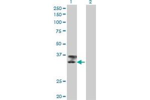 Western Blot analysis of TTN expression in transfected 293T cell line by TTN monoclonal antibody (M09), clone 6H5. (Titin anticorps  (AA 1-110))