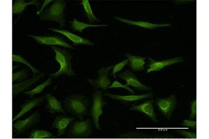 Immunofluorescence of monoclonal antibody to MAGEA3 on HeLa cell. (MAGEA3 anticorps  (AA 44-114))