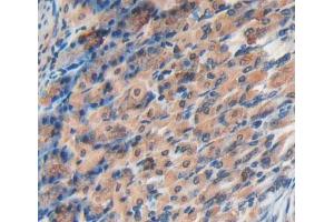 Used in DAB staining on fromalin fixed paraffin- embedded stomach tissue (EPRS anticorps  (AA 1007-1512))
