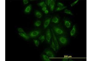Image no. 3 for anti-ARP3 Actin-Related Protein 3 (ACTR3) (AA 1-419) antibody (ABIN599115) (ACTR3 anticorps  (AA 1-419))