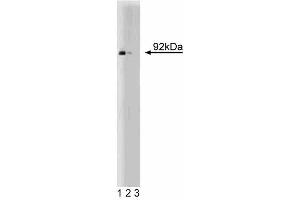 Western blot analysis of Stat5 on human endothelial cell lysate. (STAT5A anticorps  (AA 451-649))