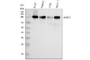 Western blot analysis of SORT1 using anti-SORT1 antibody (ABIN7606352).